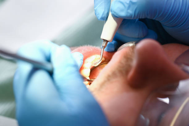 Best Emergency Gum Pain Relief  in Clinton, AR