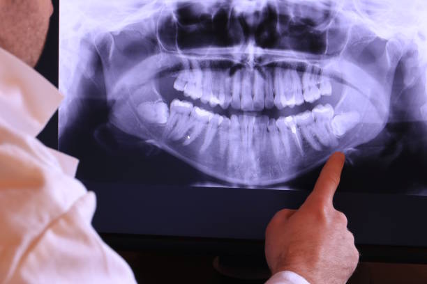Best Broken Tooth Emergency  in Clinton, AR